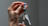 Measles outbreak in 2025 cost almost...